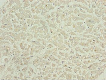 CAMK2D Antibody