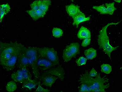 CAMK2N2 Antibody