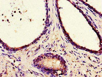 CANX Antibody
