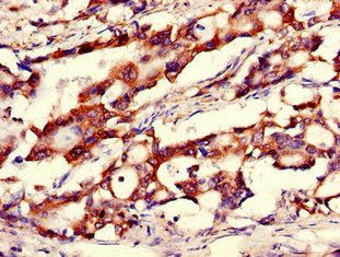 CANX Antibody