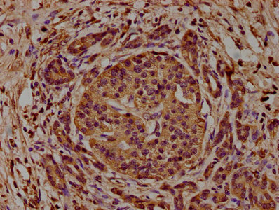 CAP1 Antibody