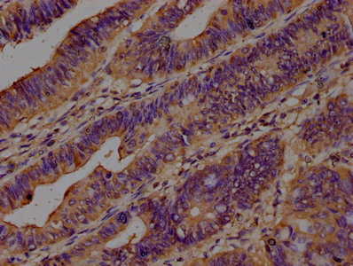 CAP1 Antibody
