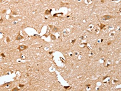 CAPG Antibody