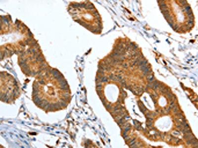 CAPG Antibody