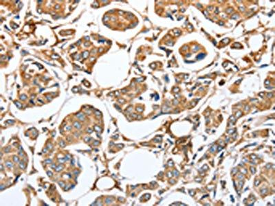 CAPG Antibody