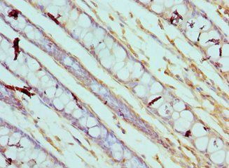 CAPN3 Antibody