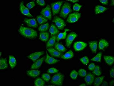 CAPRIN1 Antibody