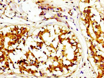 CAPRIN1 Antibody