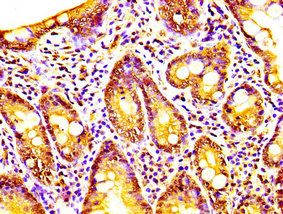CAPRIN1 Antibody