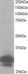 CAPZB Antibody