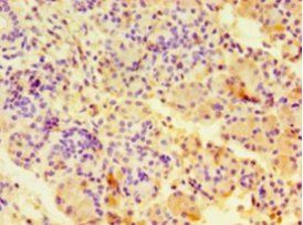 CA12 Antibody