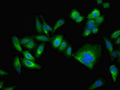 CA2 Antibody