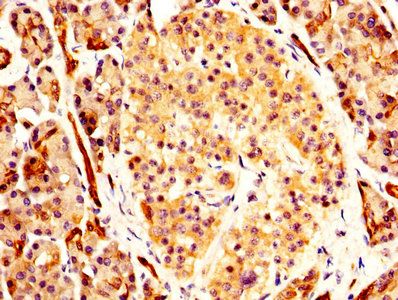 CA2 Antibody