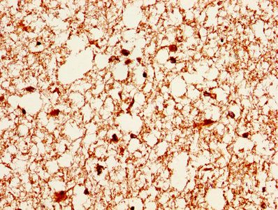 CA2 Antibody