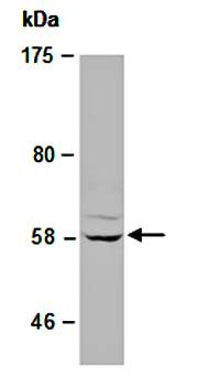 CASP10 (M) Antibody, Rabbit Polyclonal