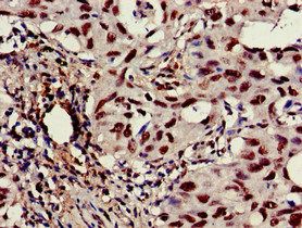CASP6 Antibody