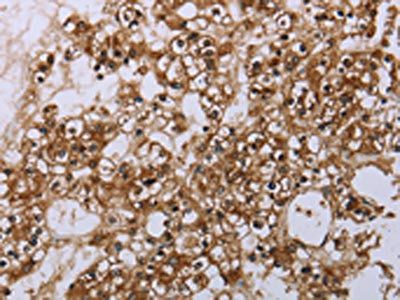 CASP8AP2 Antibody