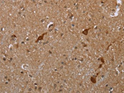 CASP8AP2 Antibody