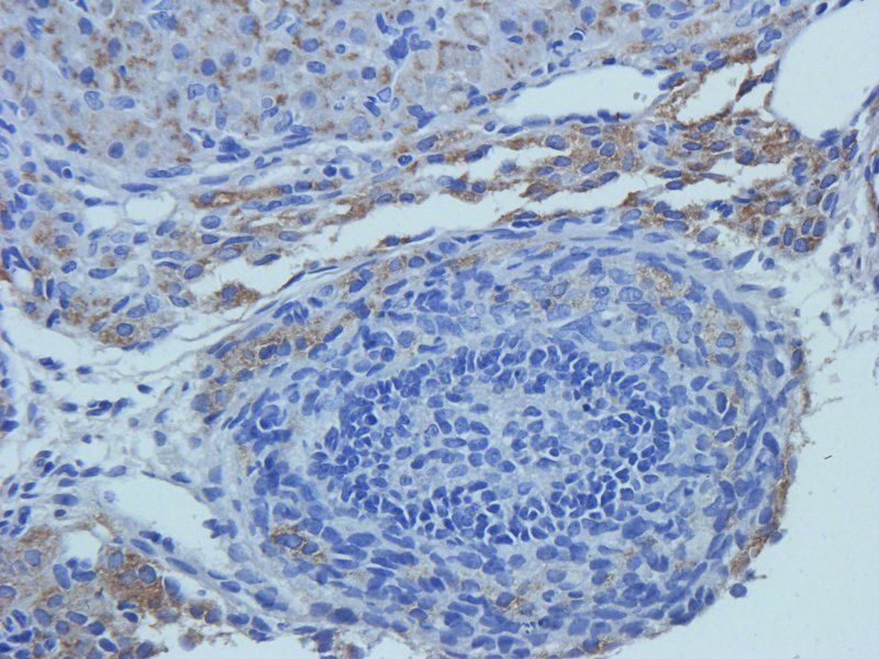 Caspase 3 Rabbit Polyclonal Antibody