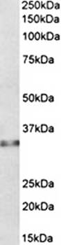 Caspase 6 (alpha) Antibody