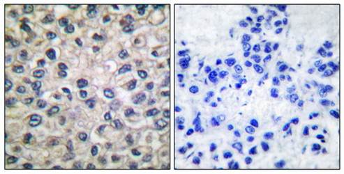 Catenin-α1 Antibody