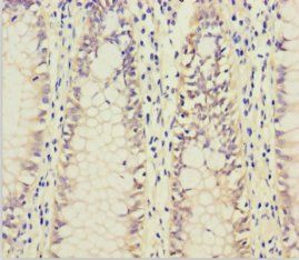 CTNNB1 Antibody