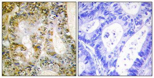 Catenin-β1 Antibody
