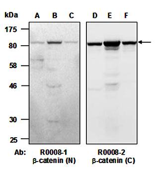 beta-Catenin1 (vPairTM) Antibodies