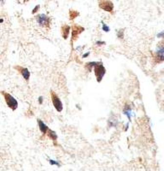 Alpha 2 Catenin Rabbit Polyclonal Antibody