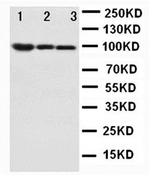 beta Catenin/CTNNB1 Rabbit Polyclonal Antibody