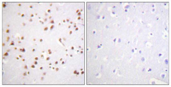 Catenin-δ1 (Ab-228) Antibody