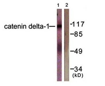 Catenin-δ1 (Ab-228) Antibody