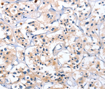 CATSPER1 Rabbit Polyclonal Antibody