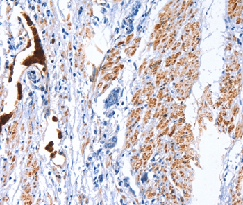 CATSPER1 Rabbit Polyclonal Antibody