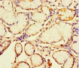 CATSPER4 Antibody