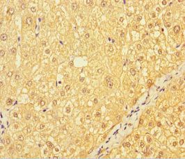 CATSPER4 Antibody