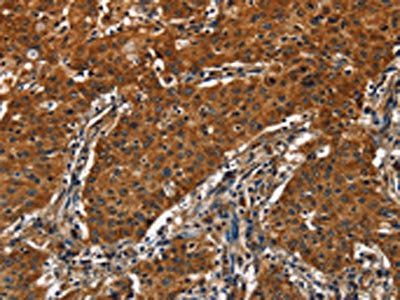 CATSPER4 Antibody