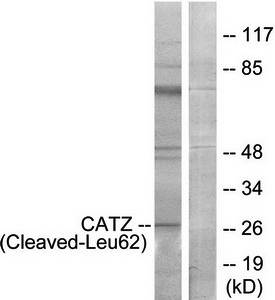 CATZ (Cleaved-Leu62) Antibody