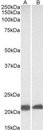 CAV3 Antibody