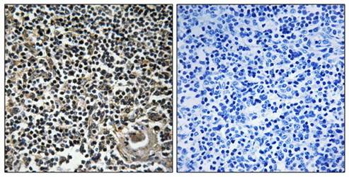 CBLN4 Antibody