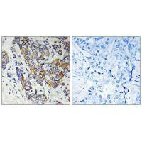 CBR1 Antibody