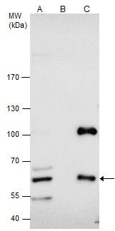 CBS antibody