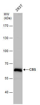 CBS antibody