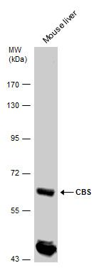 CBS antibody
