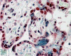 CBX3/HP1 Gamma Antibody