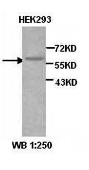 CBX4 Rabbit Polyclonal Antibody