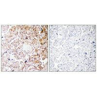 CCDC102B Antibody