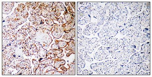 CCDC102B Antibody