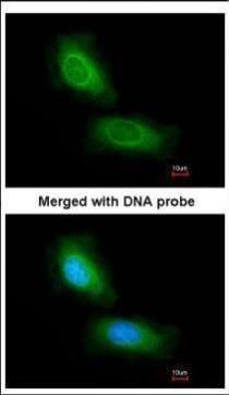 CCDC68 Rabbit Polyclonal Antibody