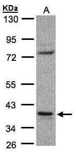 CCDC68 Rabbit Polyclonal Antibody